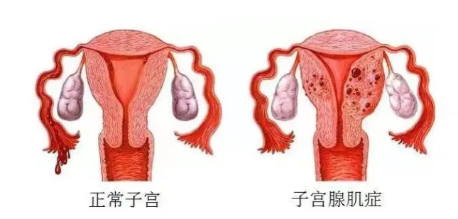 a1f4f5c36dc086bddbd4de364328101.png