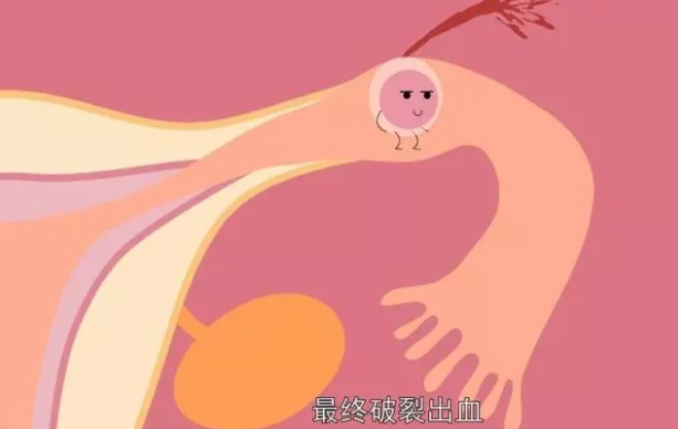 9a35597689563b8c00c111c9f06fcf6.png